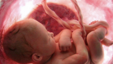 Αμβλώσεις: κύρια αιτία θανάτου παγκοσμίως το 2025