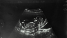 Ρεκόρ αμβλώσεων στη Βρετανία – Σχεδόν 300.000 το 2023